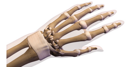 Artrosi polso mano cause e sintomi